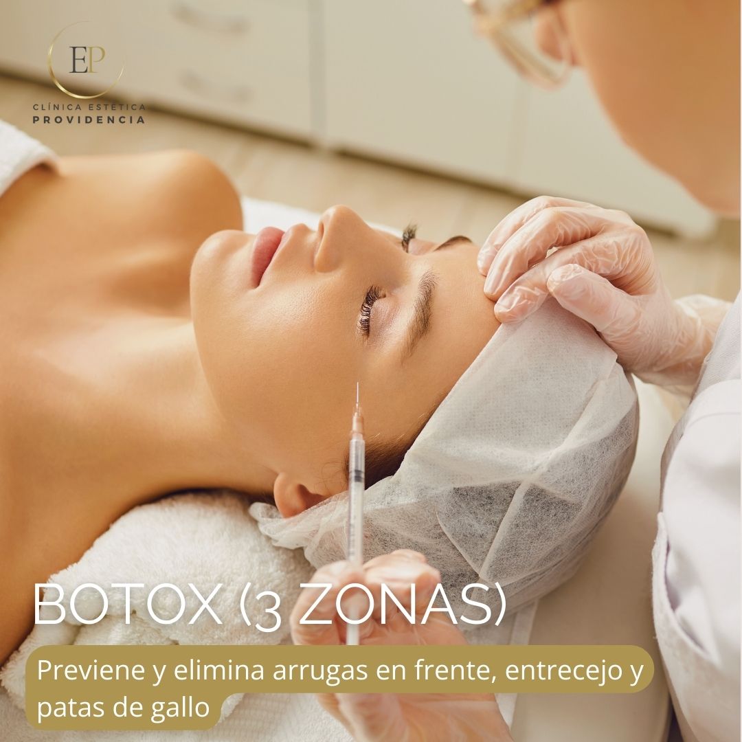 Atenúa Y Disminuye Arrugas Con Botox 3 Zonas Clínica Estética Providencia 3813